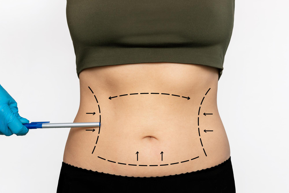 weight loss