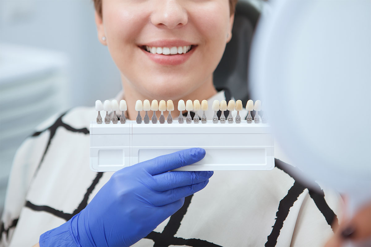 Benefits of Dental Implant
