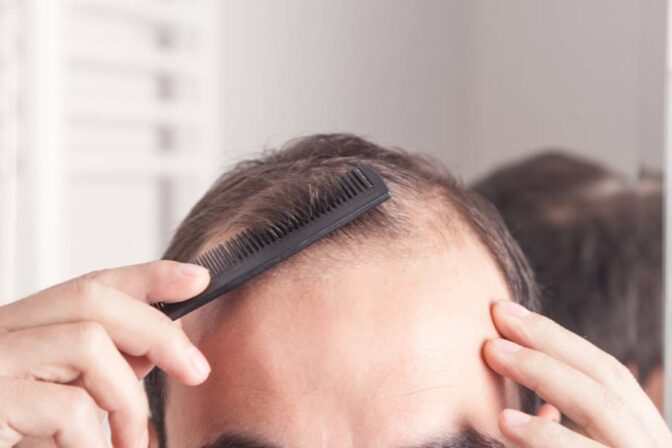 The Best Candidates for Hair Transplantation Surgery