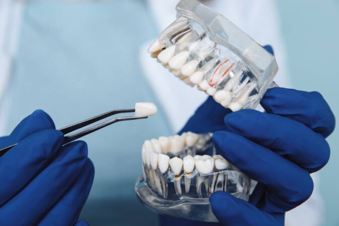 Benefits of Modern Dental Treatment