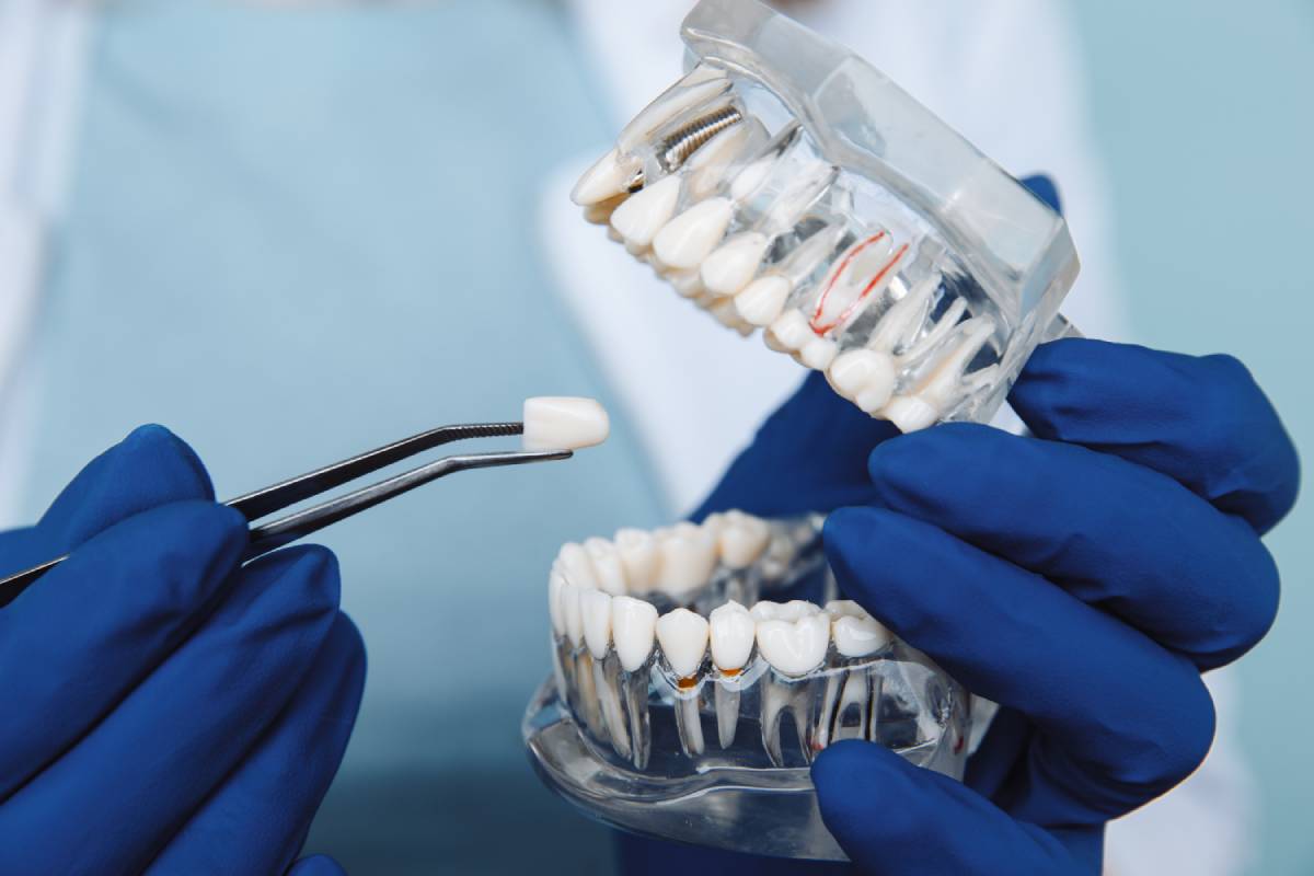 Benefits of Modern Dental Treatment