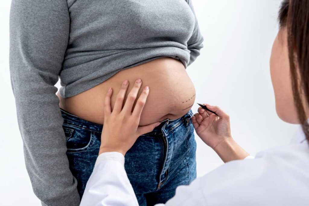 life-changing-benefits-of-obesity-surgery